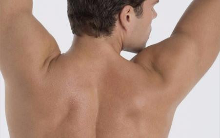 Laser for Men: Full back or full chest & stomach and shoulders (save €301)