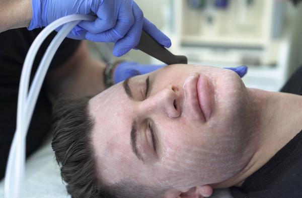 Luxury SaltFacial 3-Step Skin Renewal Therapy course of 4 (save €131)